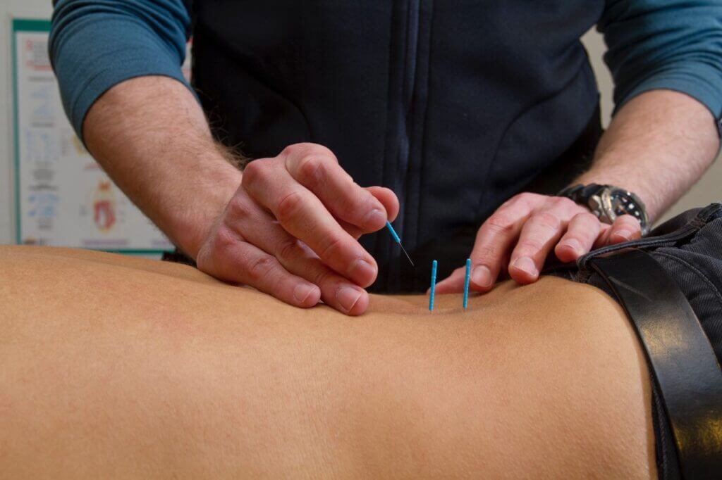 Akupunktur er effektiv smertebehandling